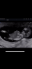 6D73C2AE-16B6-4350-B2A6-81EA7271527F.png