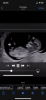 84D40CF7-C77F-4E57-A751-17E335BF4666.png