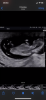 01472E7B-5B0C-41D4-962A-BF6D92CF6087.png