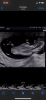 CF6ED37B-D5E4-487A-BEB3-FBB07B199048.png