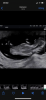 A009DEAA-B20A-473A-BEF7-5AD478DD7886.png