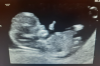 baby echo.PNG