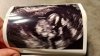 20201112_194128.jpg