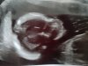 20201118_141710.jpg