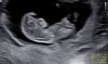 SmartSelect_20201124-203141_Gallery.jpg