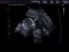 ECHOBABYBREDA_0011.jpg