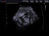ECHOBABYBREDA_0004.jpg