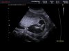 ECHOBABYBREDA_0008.jpg