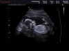 ECHOBABYBREDA_0005.jpg
