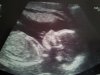 Baby pic-1.jpg