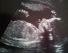 Baby pic-2.jpg