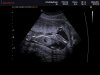 ECHOBABYBREDA_0014.jpg