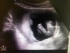 itsagirl.jpg