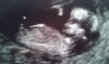 Echo 12 wkn 110413.jpg