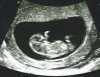 Echo10w5d.jpg