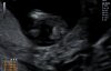 20201125_195617.jpg