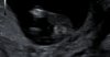 Screenshot_20201125-213836_Gmail.jpg