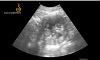 2020-12-01 12.12_12942795.png