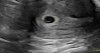 D3ADDB0E-8A8D-4E97-A18F-67307B93712C.jpeg