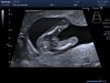 I202012091326415170027.jpg