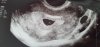 20201216_112228.jpg