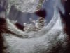 20201219_120815.jpg