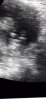 Screenshot_20201224-074639_Video Player.jpg