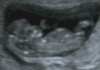 Baby 10+4 5.png