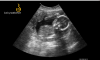 19259_2021-01-03_11.26_112325997.png