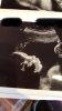 5677F228-5D78-432D-9F04-1A31C4AEFFA2.jpeg