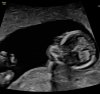 20210120_090616.jpg