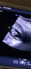 ED638C37-9096-47D4-820C-579DFC1DC415.png