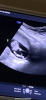 C9F2D73A-9C74-467C-972E-83B426A5B2EA.png