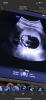 528437DA-024A-4B27-B540-E91D6BC46046.png