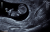 baby2021.png