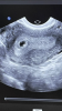 477EDCDB-CEDC-4673-9BA0-26057EC10E85.png