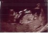 baby 1.jpg