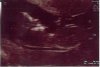 baby 2.jpg