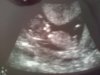 echo25-4-13.jpg