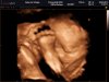 BABY VAN SCHAGEN_0016.jpg