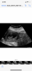 537F9541-6584-4D95-B094-47C412B0C6F8.png