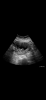 98E34872-AAAF-4506-A82A-9FD815F309DD.png
