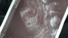 IMG-20210303-WA0011.jpeg