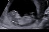 34DCE112-089A-4AE0-9577-2E04397887A3.jpeg