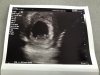 BB9F0288-E996-4C63-8028-AAE940562E01.jpeg