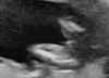 6A69490E-E16C-47F0-83C8-5A832A607C0A.png