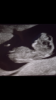 D322810D-2E42-42AB-9A64-2FEB3CAB2A4A.png