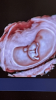 3D50CBD1-B9D8-48E3-B468-35621176FA13.png