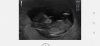 Screenshot_20210406_123110_com.android.gallery3d.jpg
