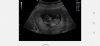 Screenshot_20210406_123117_com.android.gallery3d.jpg